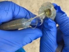 Mối liên kết của EHP và vi khuẩn Vibrio trong hội chứng phân trắng